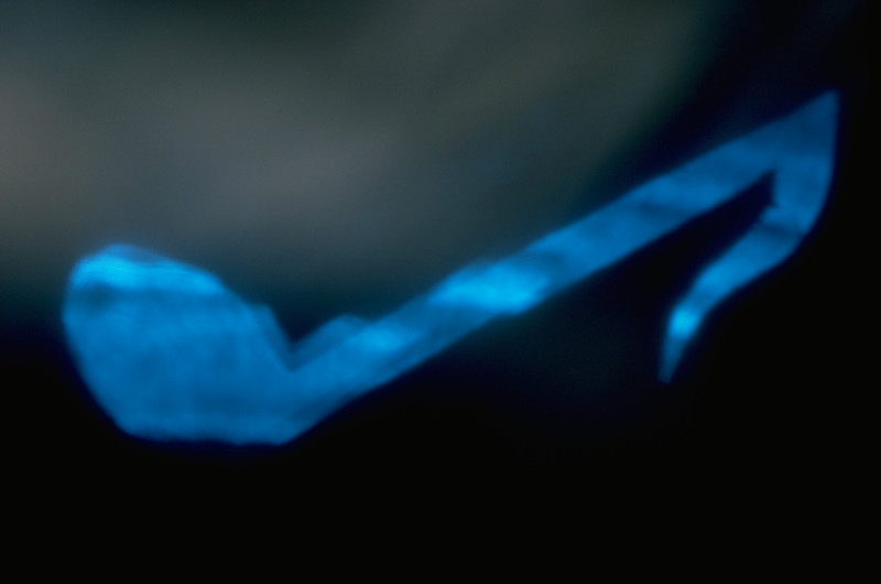 Articles for The Art of Autism